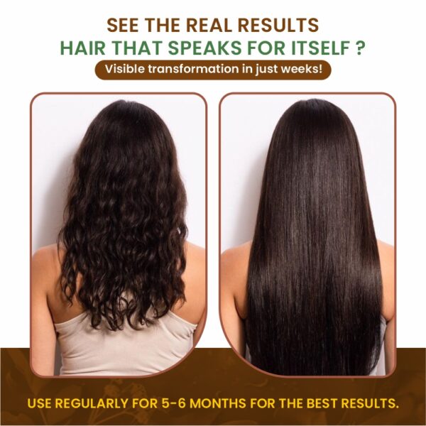 Hair Oil And Malish OIl - Image 4
